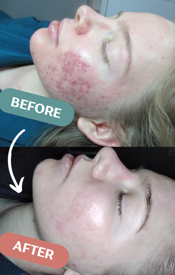 before & after