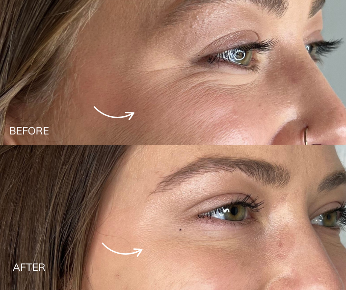 Tox B&A