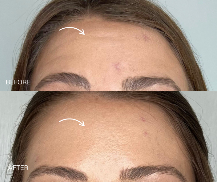 Tox B&A