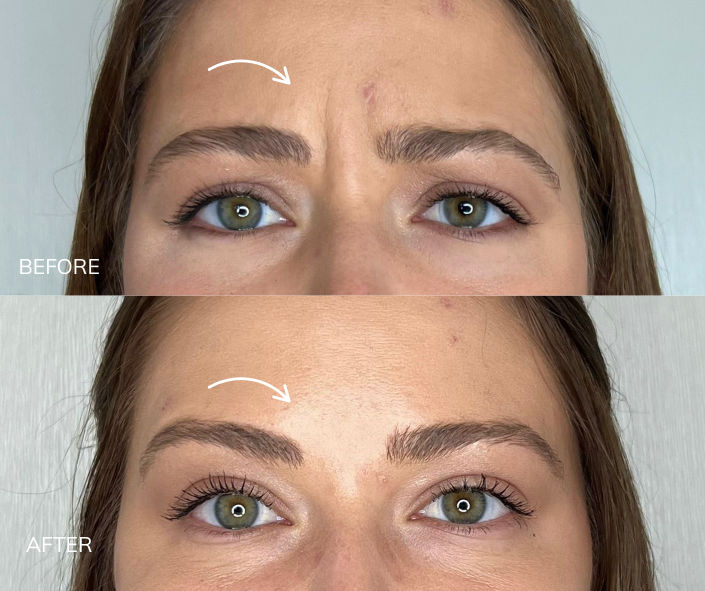 Tox B&A