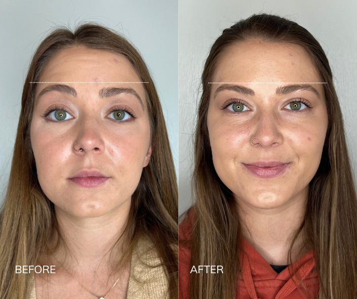 Tox B&A