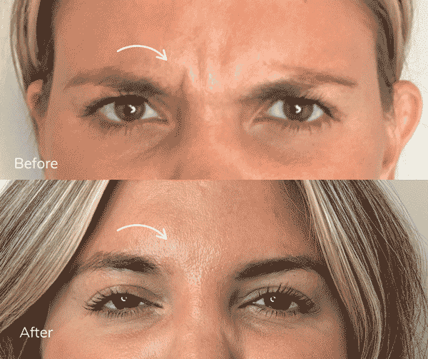 Tox B&A