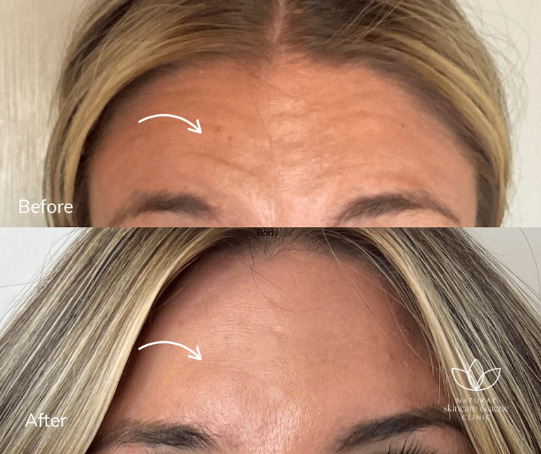 Before & After