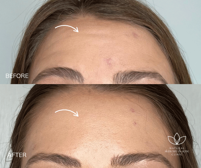 Before & After