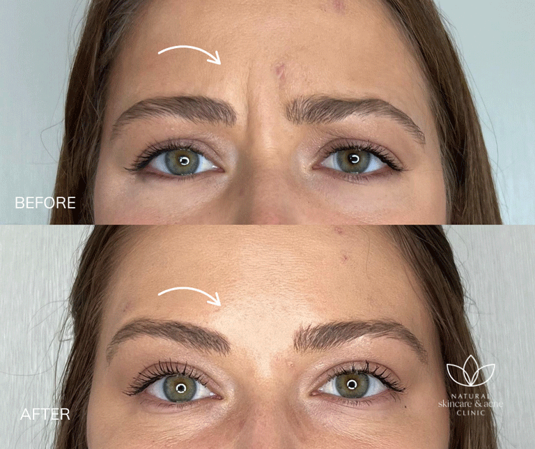 Before & After