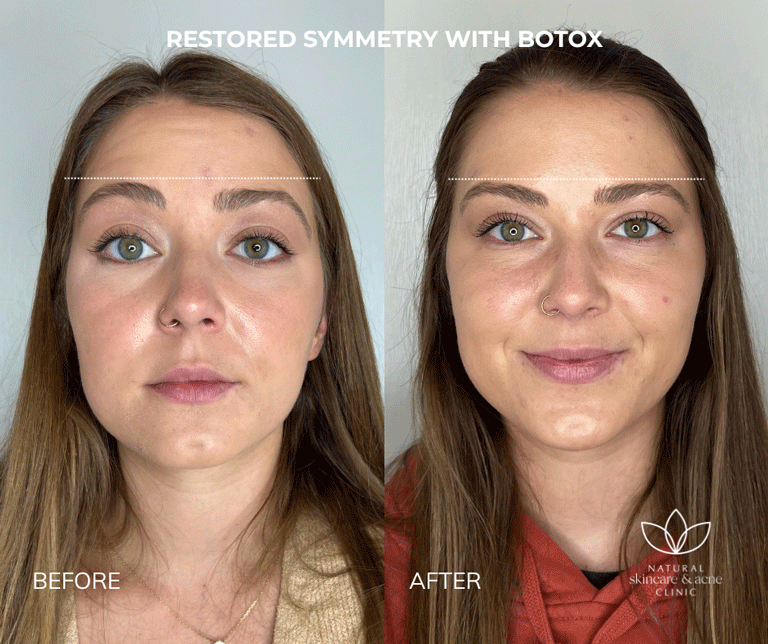 Before & After